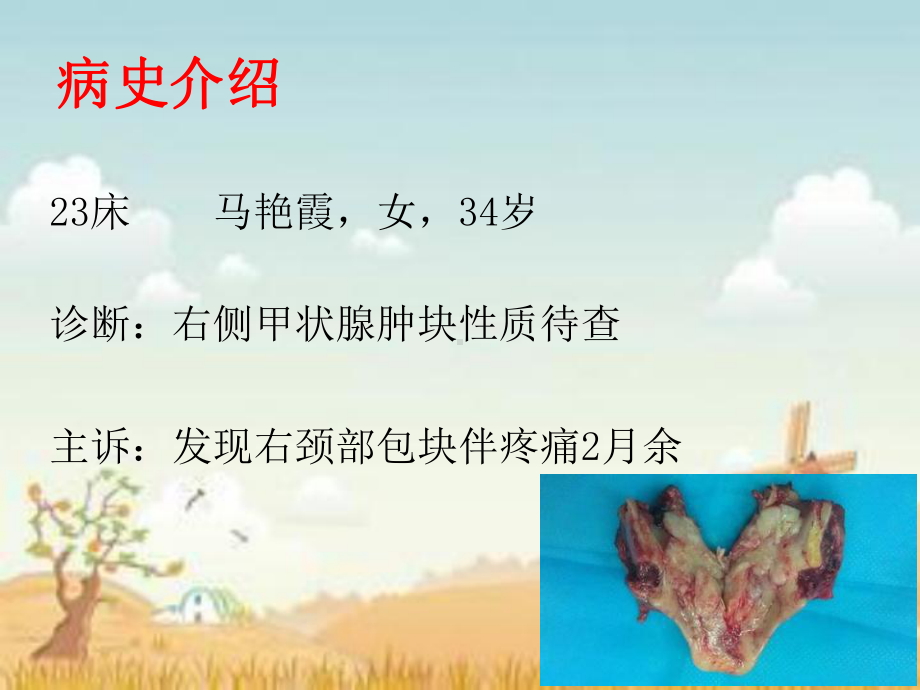 甲状腺护理查房课件-参考.ppt_第2页