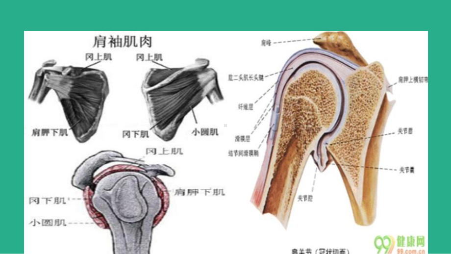 肩袖损伤的护理课件.ppt_第2页