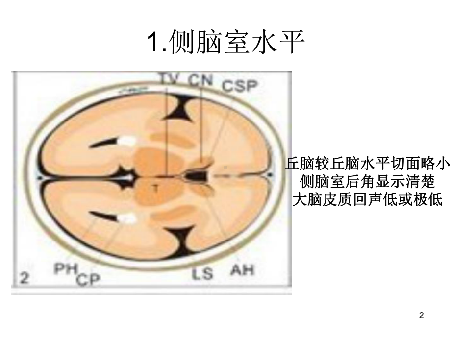 胎儿系统超声标准切面课件.ppt_第2页