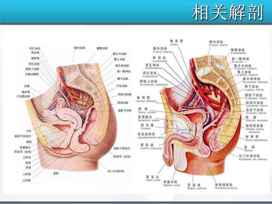 经腹直肠癌根治术、结肠造瘘术-手术配合-课件.ppt_第3页