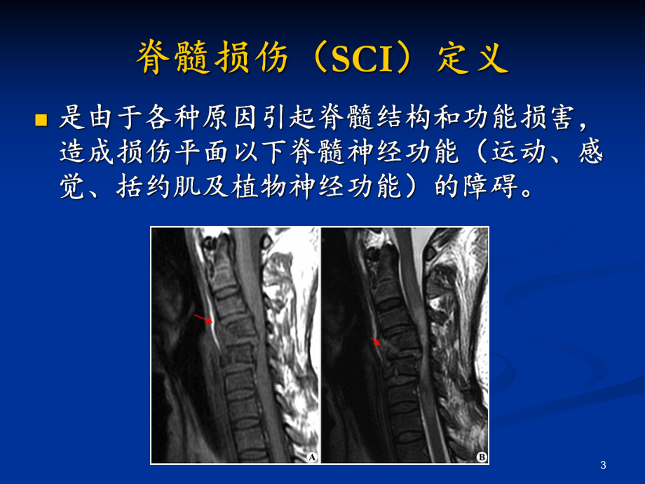 脊髓损伤康复课件-参考.ppt_第3页