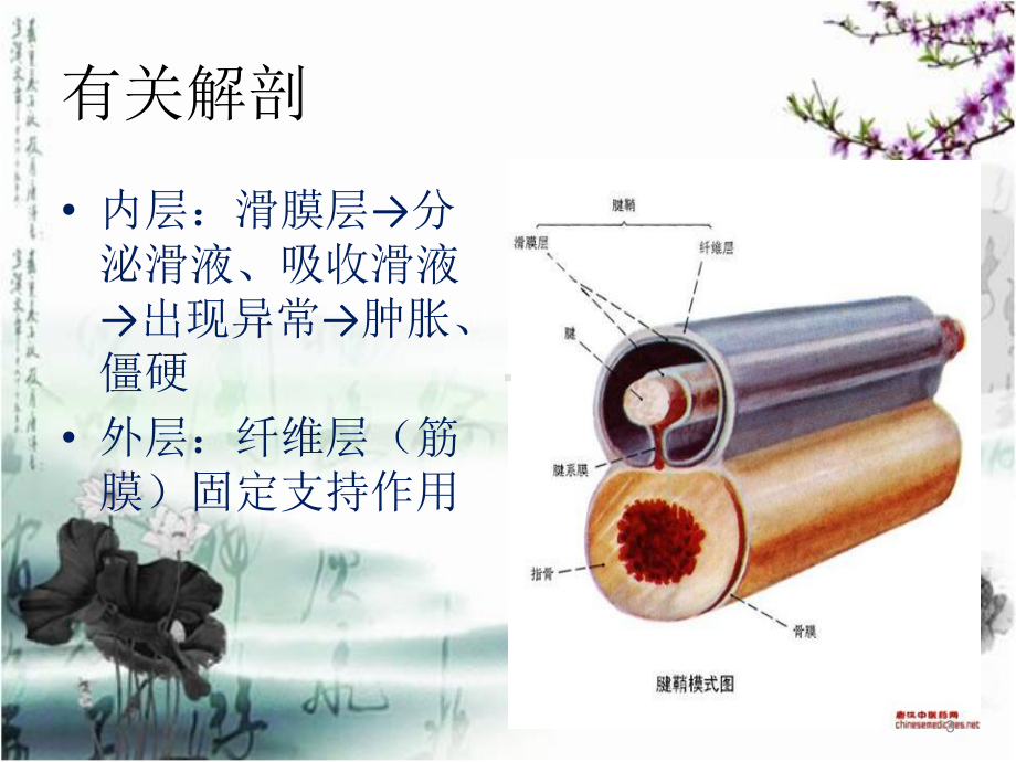 腱鞘炎教学讲解课件.ppt_第3页