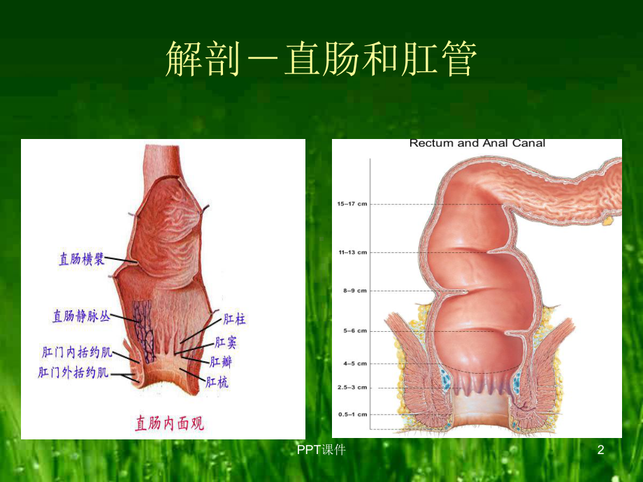 直肠肛管疾病病人的护理-课件.ppt_第2页