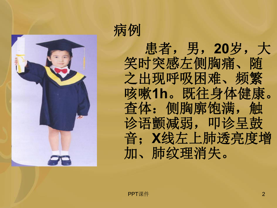 自发性气胸--课件.ppt_第2页