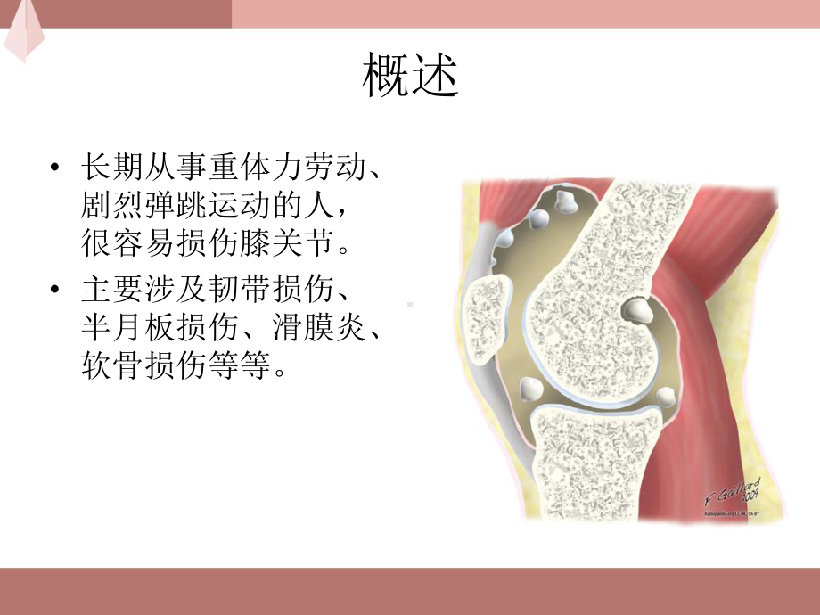 膝关节针灸治疗-课件.ppt_第2页