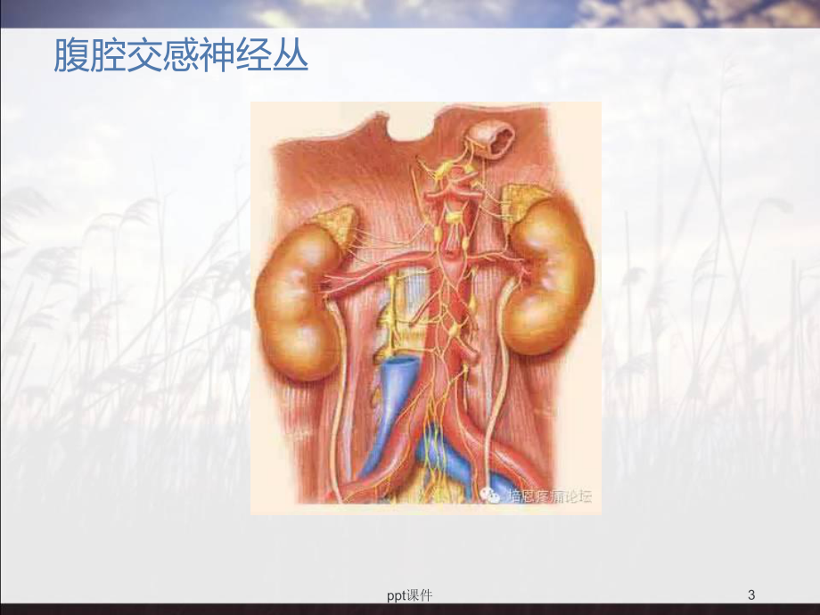 腰交感神经介入治疗-课件.ppt_第3页