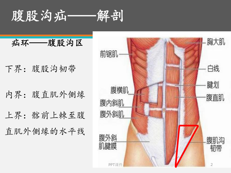 腹股沟疝-课件.ppt_第2页