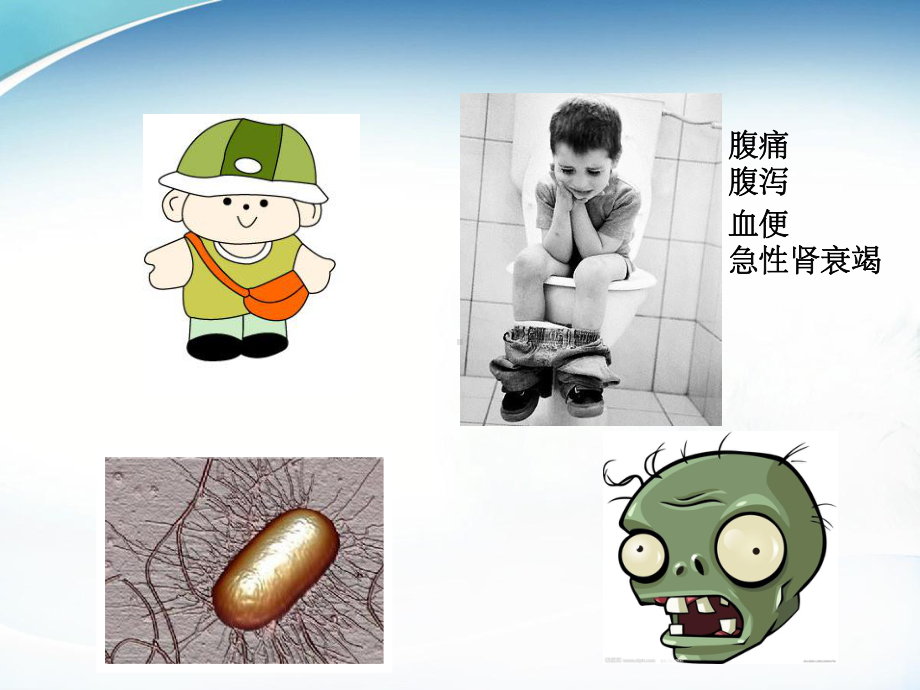 肠杆菌科课件-参考.ppt_第2页