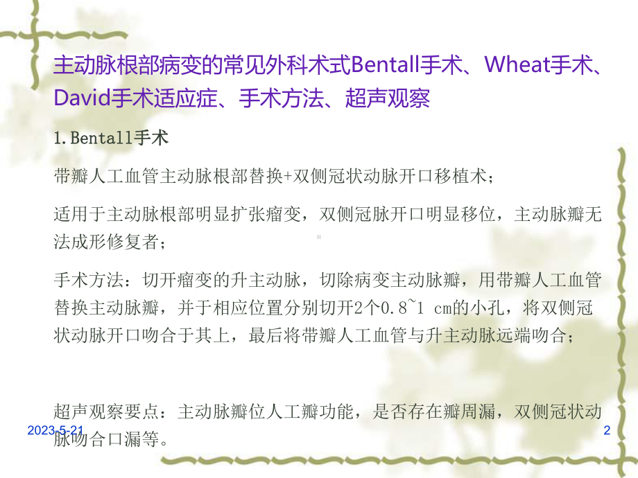 置换升主动脉置换术护理查房课件.ppt_第2页