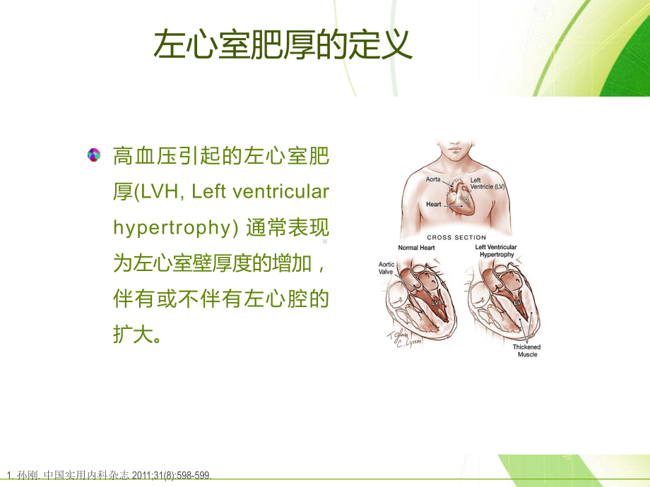 高血压与左心室肥厚-课件.ppt_第2页