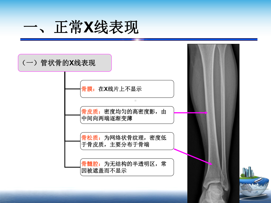 骨正常影像学表现课件.ppt_第3页