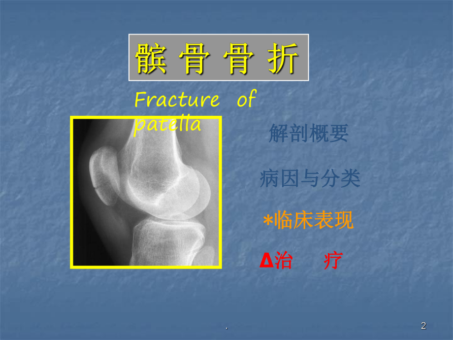 髌骨骨折教学课件.ppt_第2页