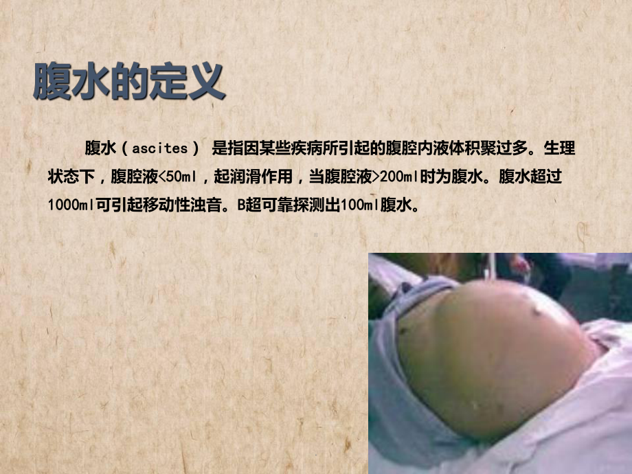 腹水教学讲解课件.ppt_第3页