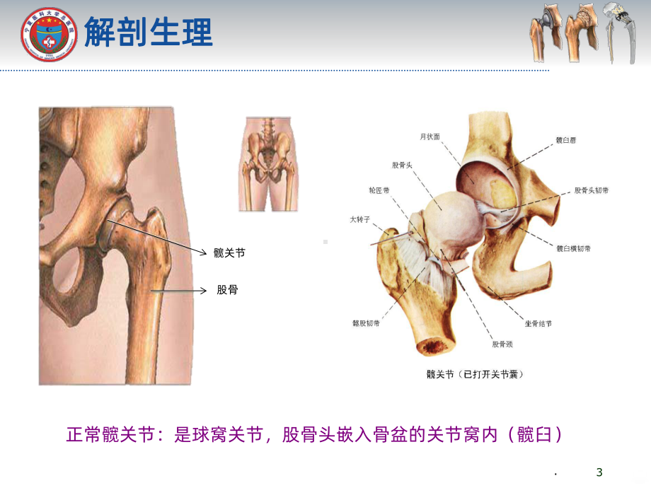 髋关节置换术后功能锻炼课件.ppt_第3页