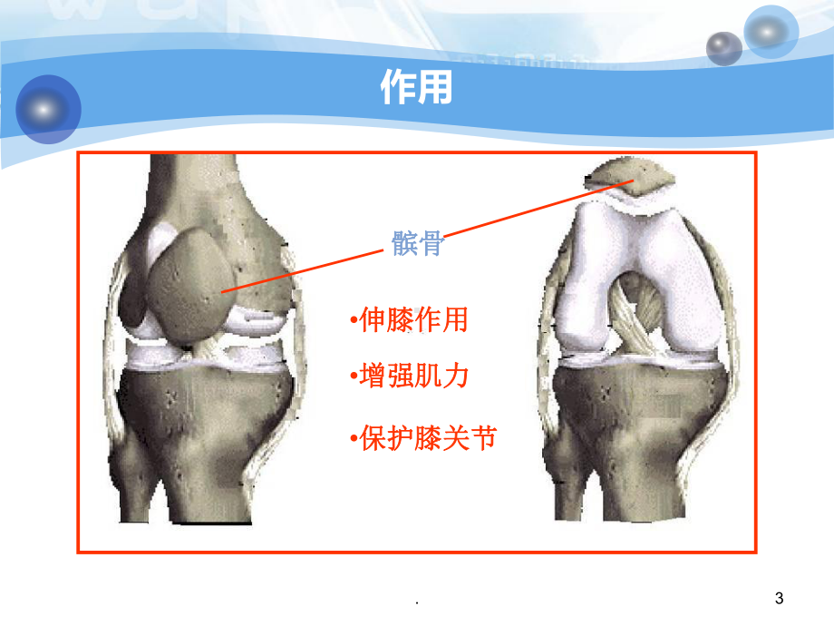 髌骨骨折护理查房-最新教学课件.ppt_第3页