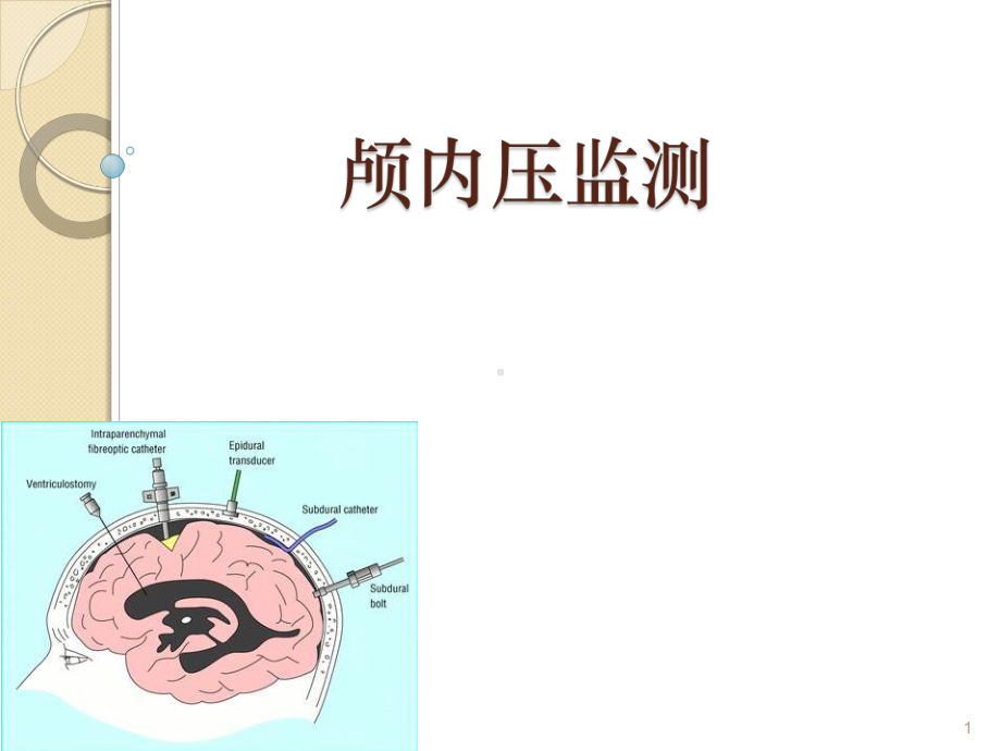 颅内压监测课件-参考.ppt_第1页