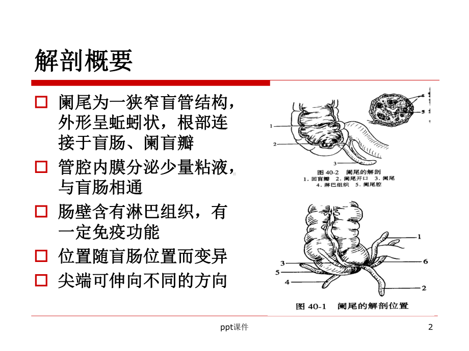 阑尾护理查房-课件.ppt_第2页