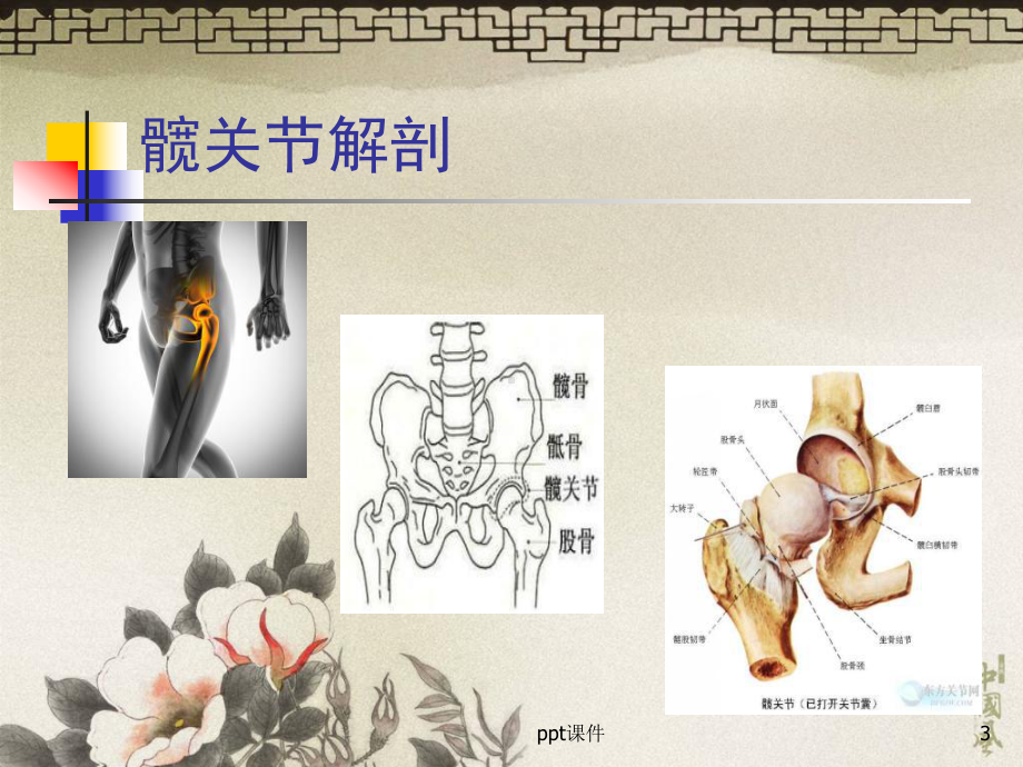 髋关节置换护理查房-课件.ppt_第3页