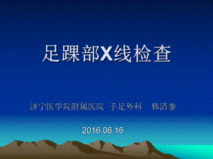 足踝部X线检查方案.ppt