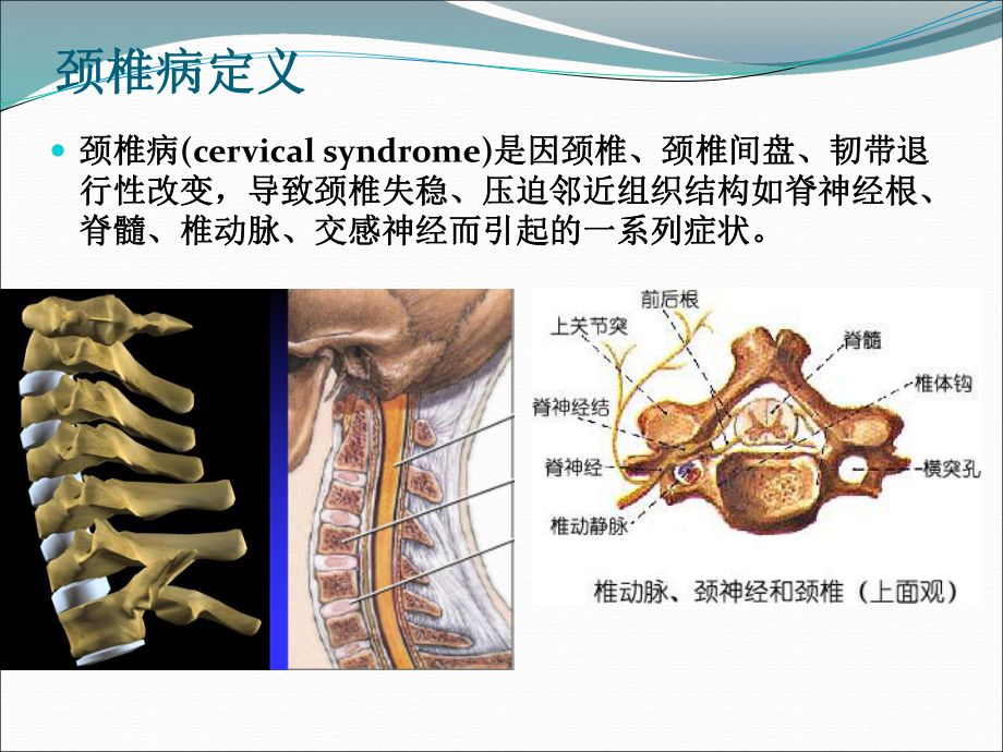 颈椎病的治疗与康复课件-参考.ppt_第2页