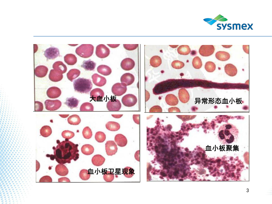 血小板的检测原理及误差分析课件.ppt_第3页