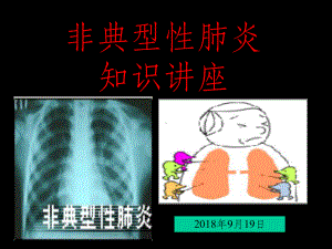 非典教学讲解课件.ppt