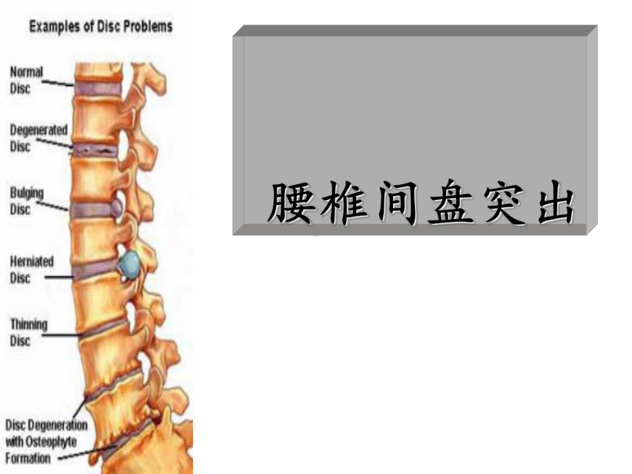 运动康复-课件.ppt_第1页