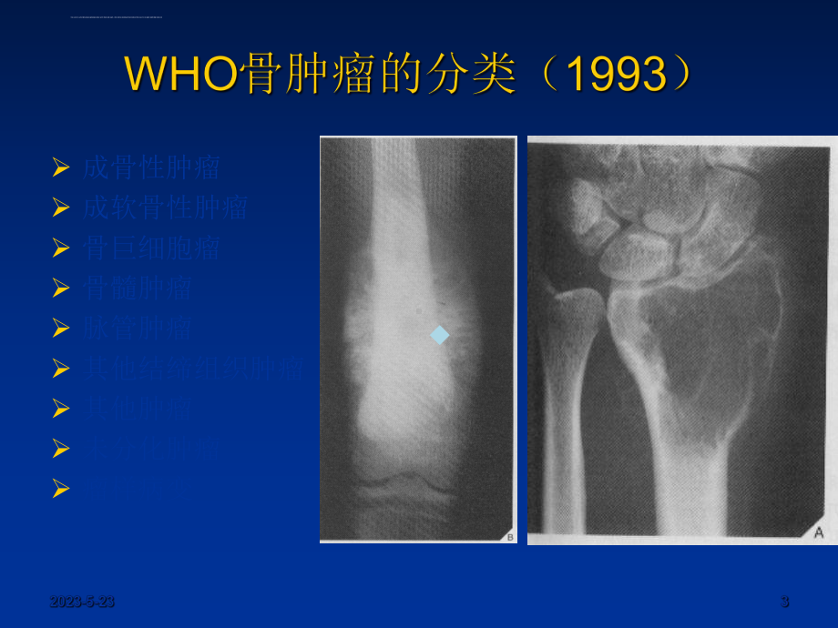 骨肿瘤课件(同名370).ppt_第3页