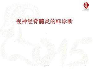 视神经脊髓炎的MR诊断-课件.ppt