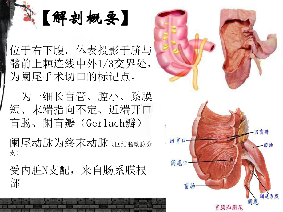 阑尾炎的护理课件.ppt_第3页