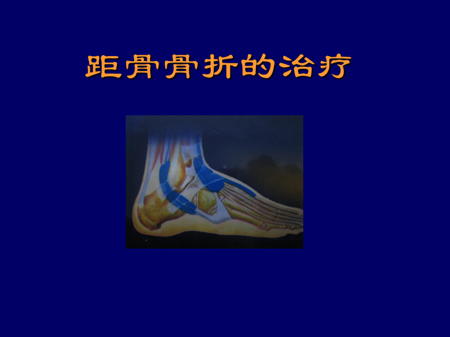 距骨骨折课件(同名338).ppt_第1页