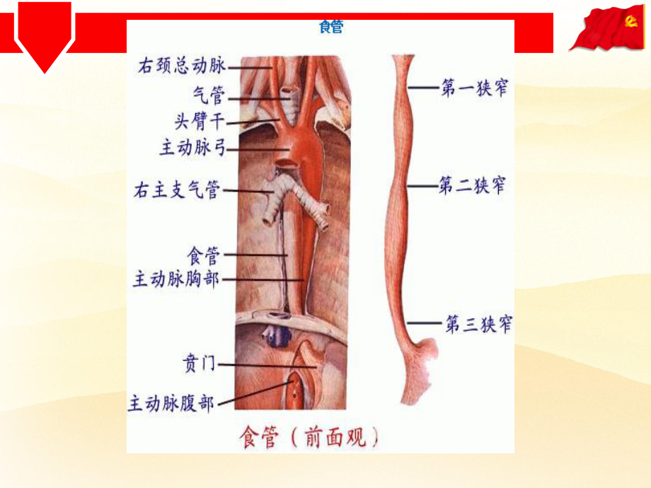 食道癌护理查房-课件.ppt_第3页