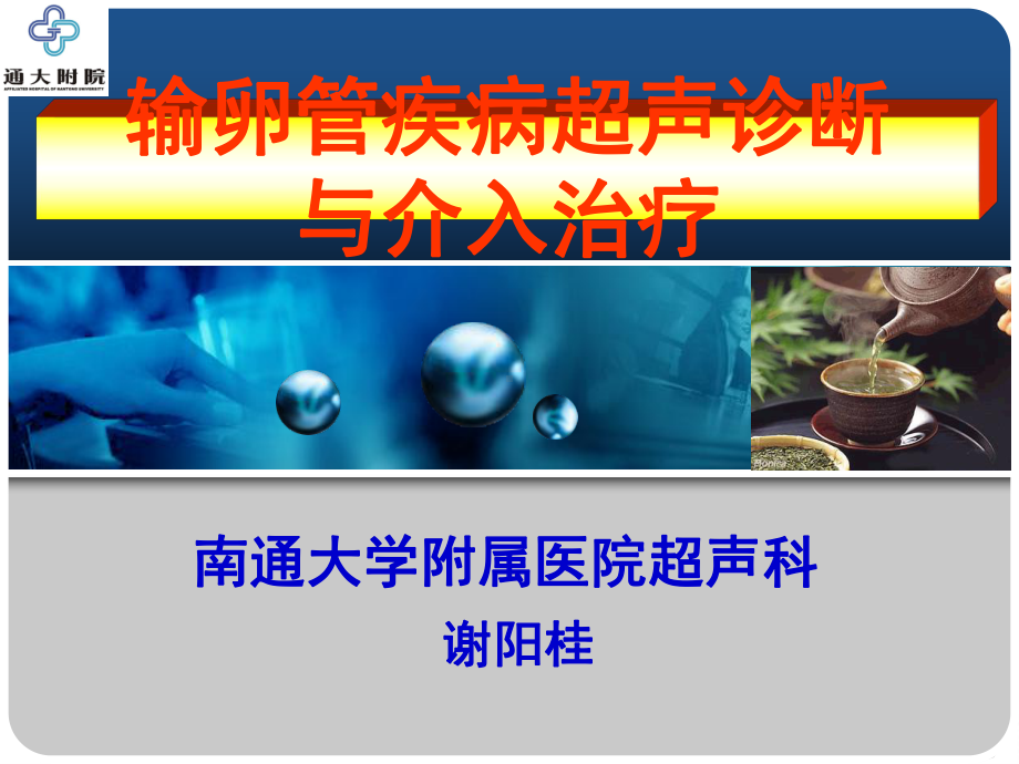 输卵管疾病超声诊断与介入治疗课件.ppt_第3页