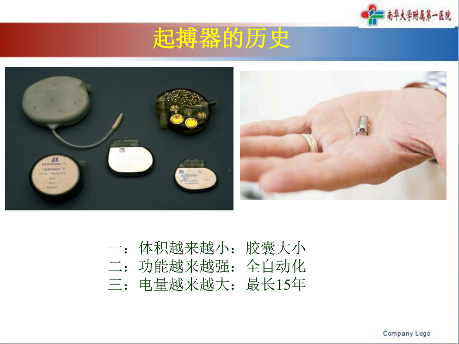 起搏器新进展方案.ppt_第3页