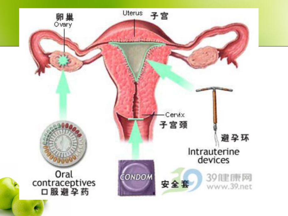 避孕与流产课件.ppt_第3页