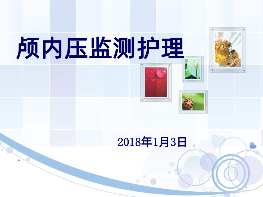 颅内压监测课件-整理.ppt_第1页