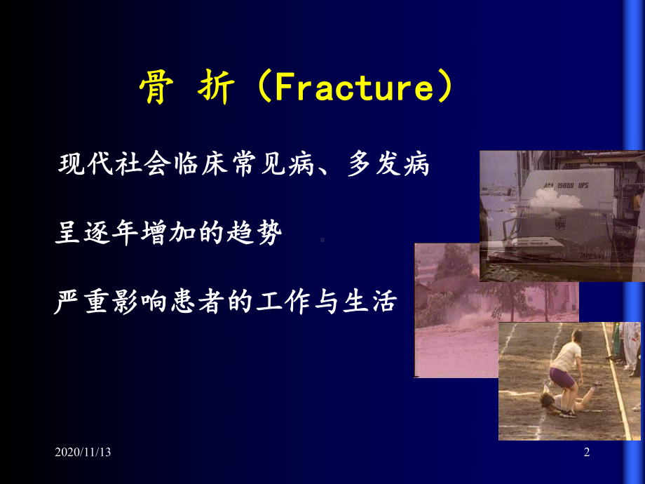 运动系统疾病-课件.ppt_第2页