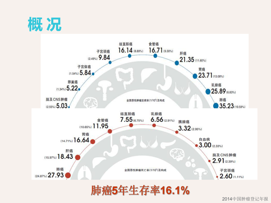 非小细胞肺癌靶向治疗新进展-课件.ppt_第2页