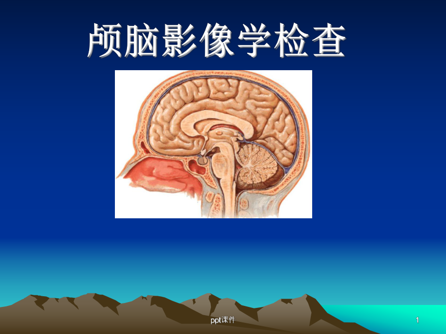 颅脑影像学检查-课件.ppt_第1页