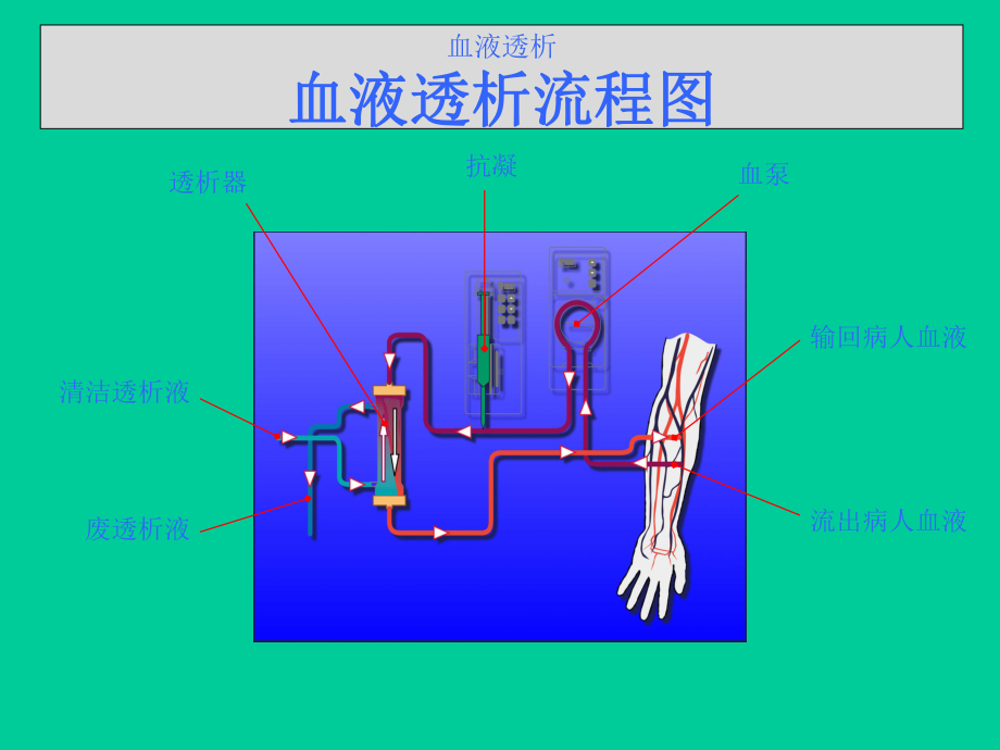 费森尤斯透析器知识课件.ppt_第2页