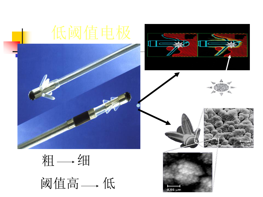 起搏部位华伟课件.ppt_第3页