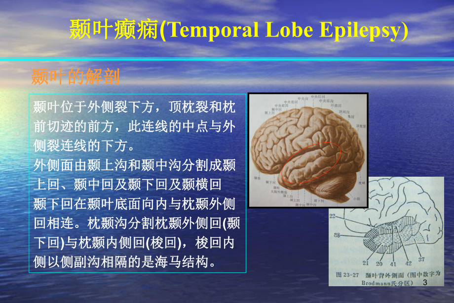 颞叶癫痫医学课件.ppt_第3页