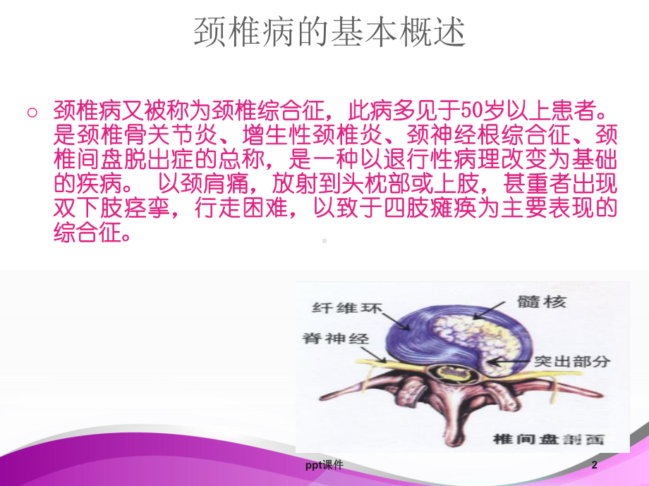 颈椎病护理查房-课件.ppt_第2页