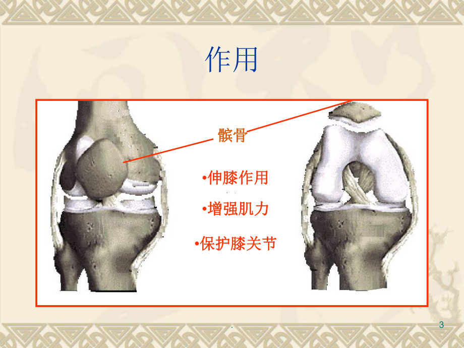 髌骨骨折护理查房教学课件.ppt_第3页