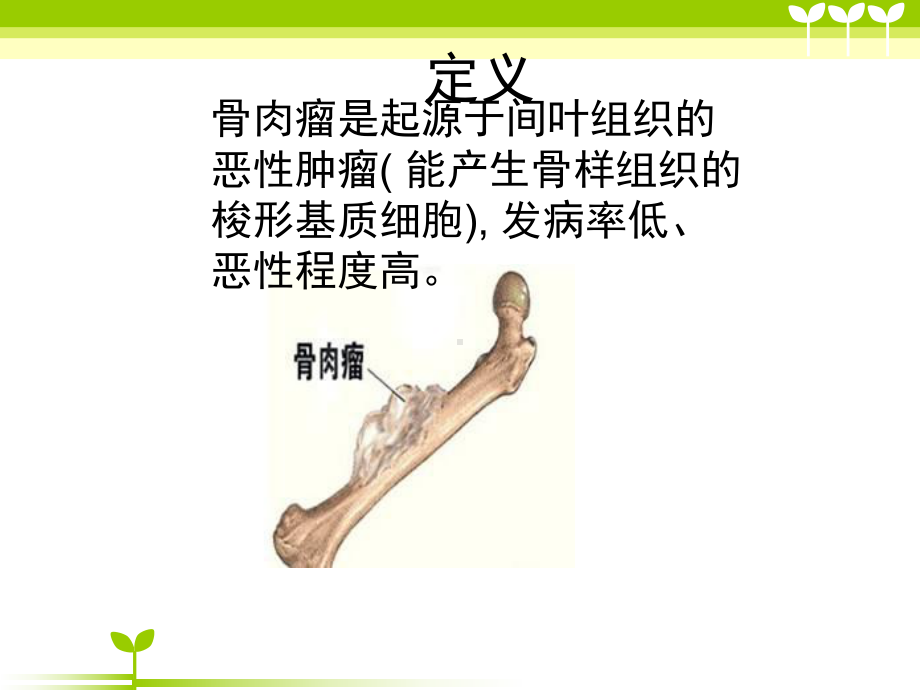 骨肉瘤教学讲解课件-参考.ppt_第2页