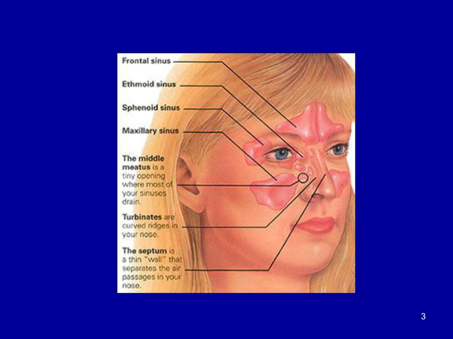 鼻窦炎课件(同名380).ppt_第3页