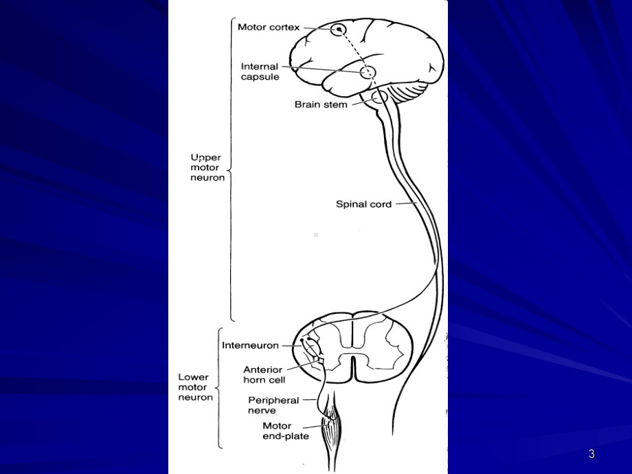 运动神经元疾病参考课件.ppt_第3页