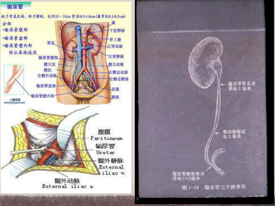 输尿管的超声检查-课件.ppt_第3页