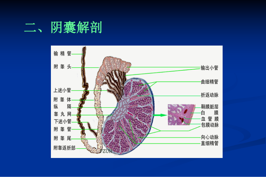 阴囊B超教学讲解课件.ppt_第2页