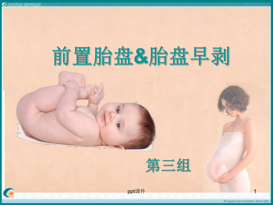 胎盘早剥与前置胎盘-课件.ppt_第1页